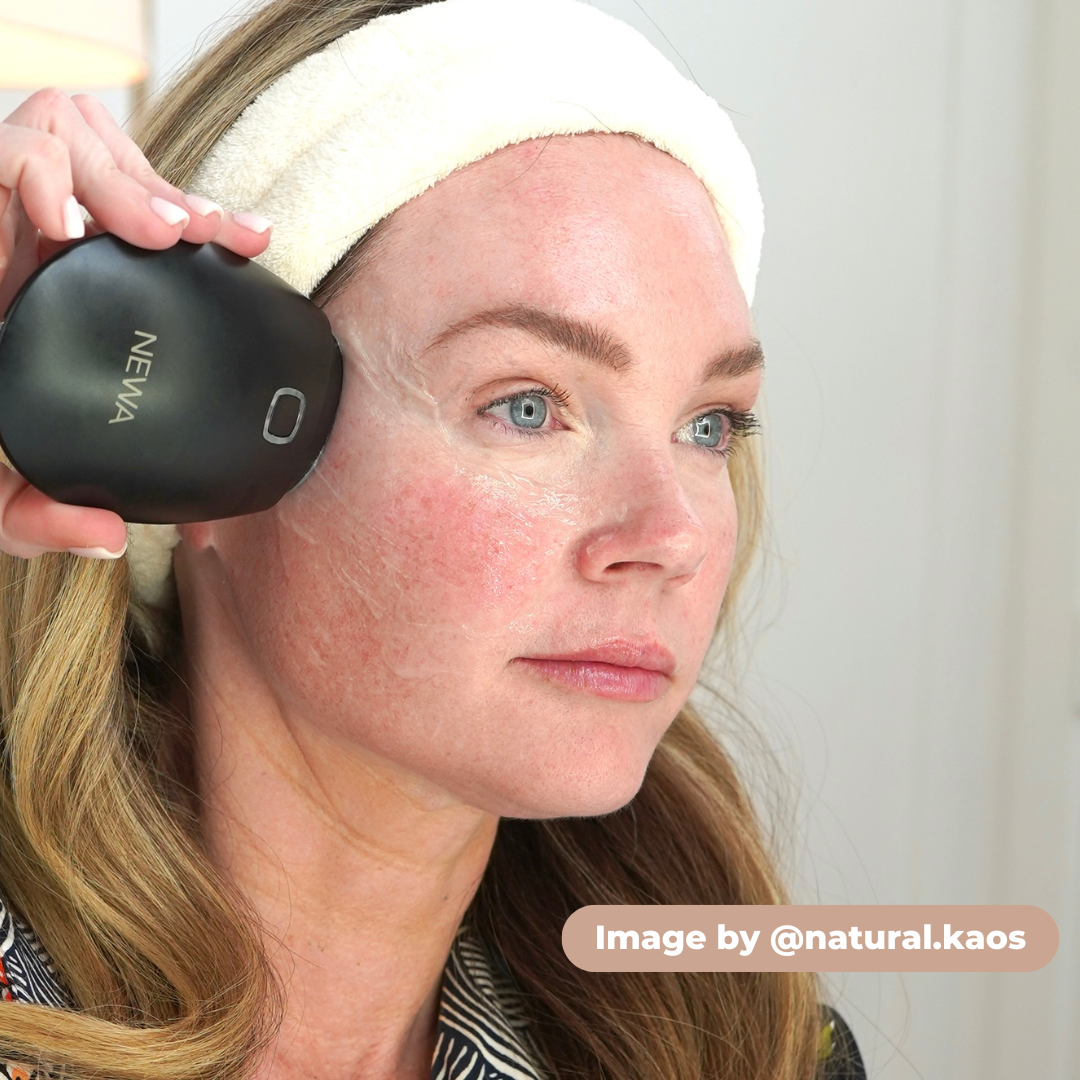 NEWA Classic RF Wrinkle Reduction Device